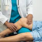 Arzt untersucht Kniegelenk mit Plica-Syndrom; Schleimhautfalte