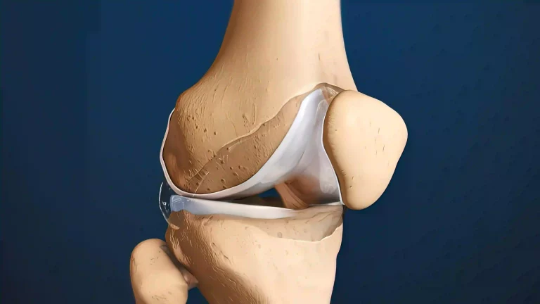 Querschnitt durch ein typisches Synovialgelenk mit Darstellung Knorpel im Knie